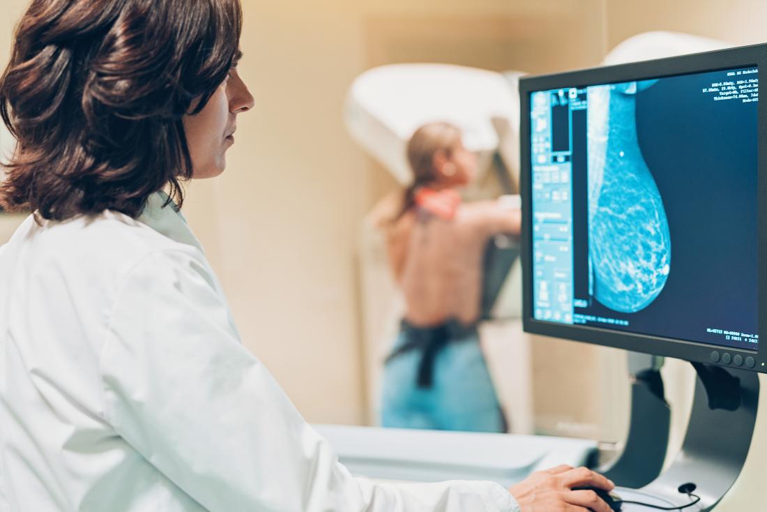 Breast cancer scan